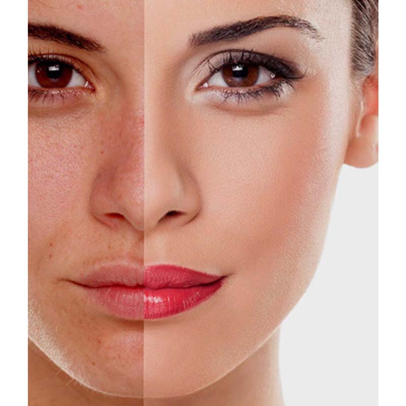 medecine-nutrition-et-danse-peeling medecine-nutrition-et-danse-peeling