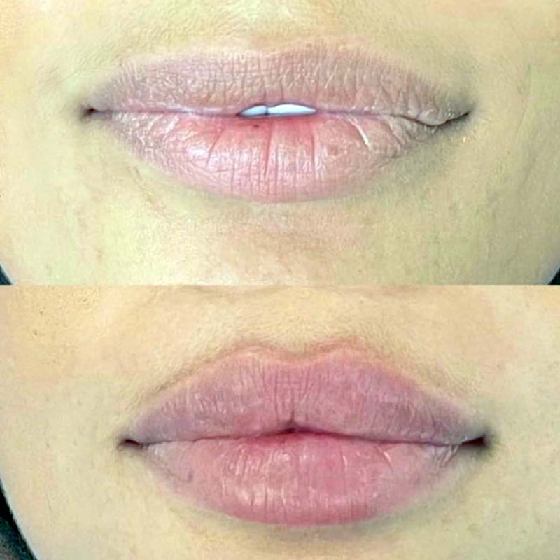 medecine-nutrition-et-danse---russian-lips medecine-nutrition-et-danse---russian-lips