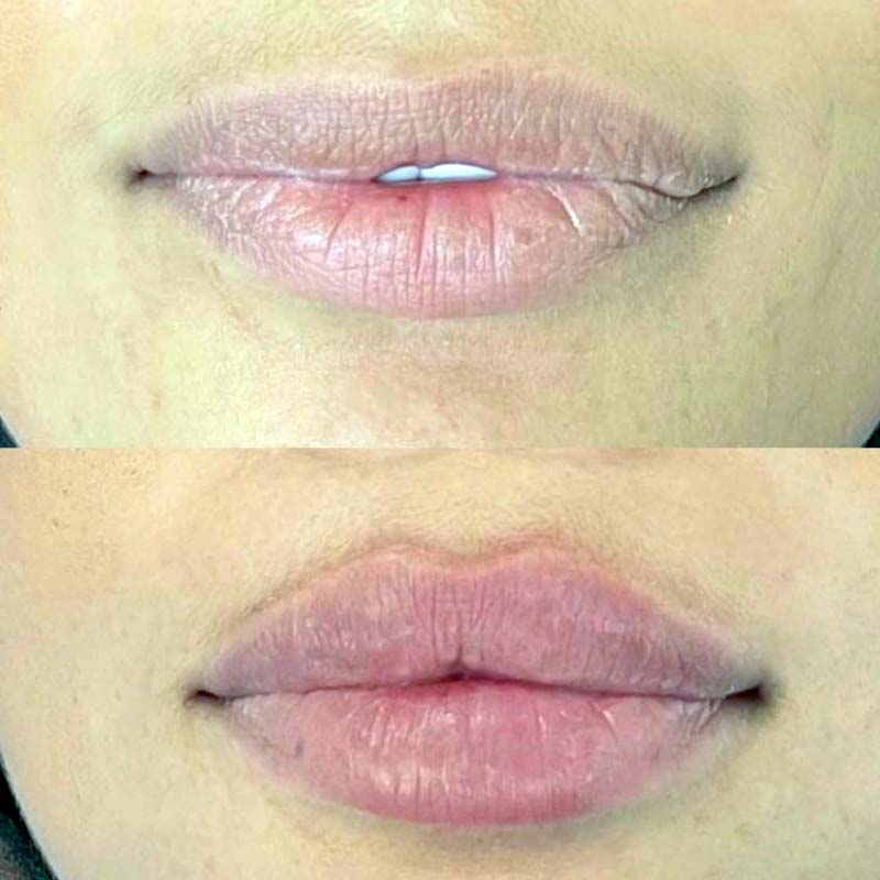 medecine-nutrition-et-danse---russian-lips