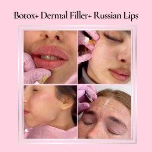 Botox + Full face filler + Russian lips online tutorial