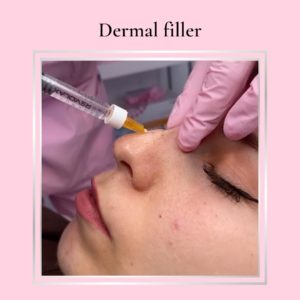 Full face filler tutorial